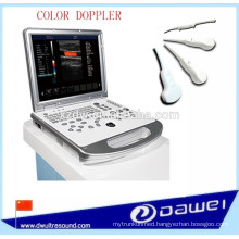 portable vascular doppler equipment & laptop ultrasound machine